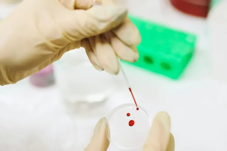 The Silent Epidemic Behind Panama’s HIV Crisis blood test