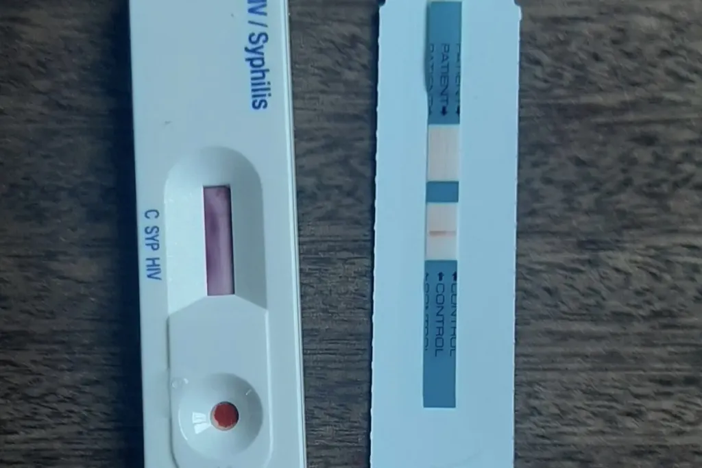 hiv and syphilis test