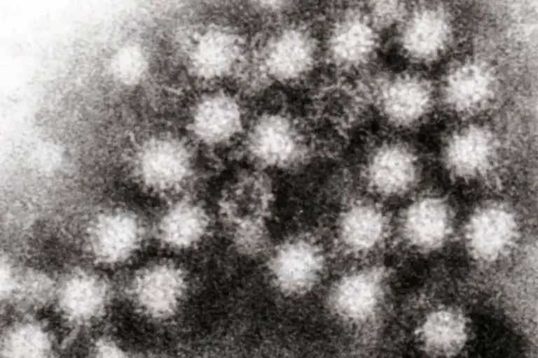 Norovirus 4
