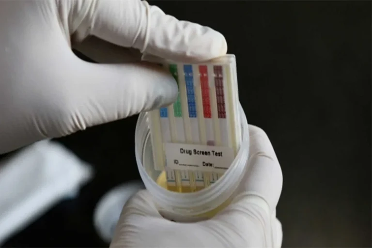 Antidoping Test
