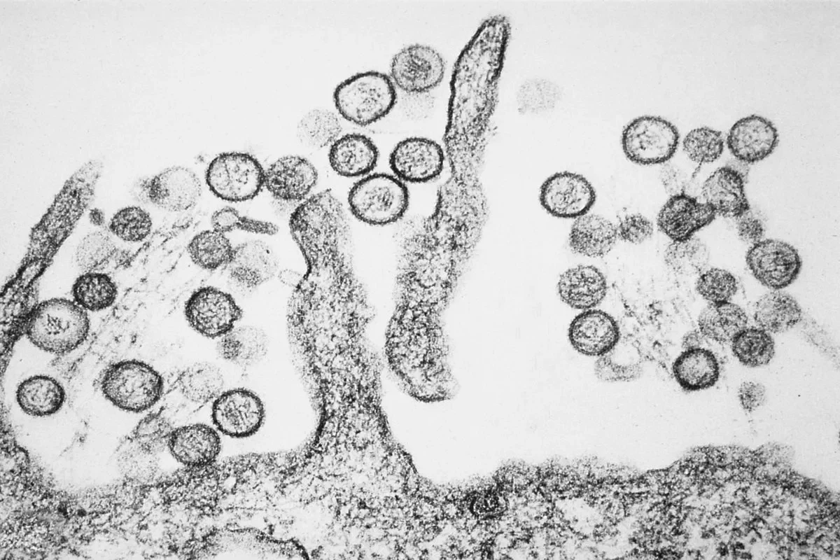 Hanta Virus on the microscope. By CDC